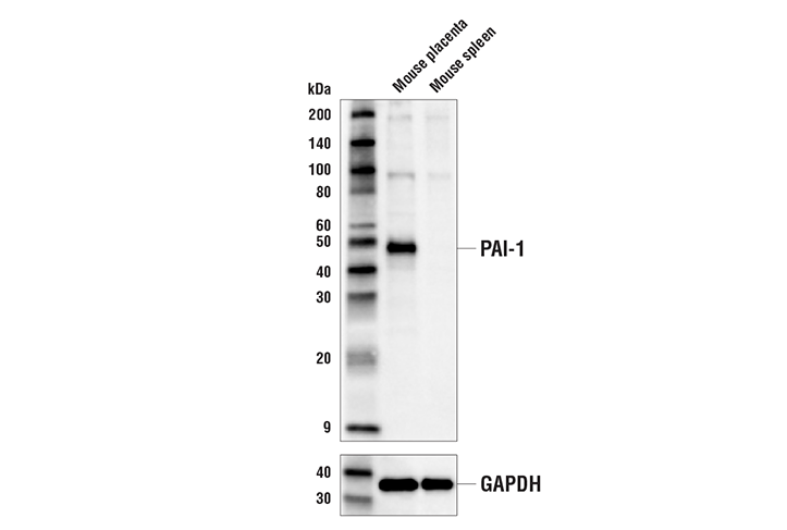 Western Blotting Image 1: PAI-1 Antibody