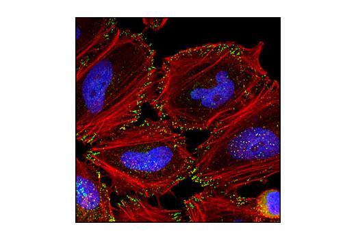 Immunofluorescence Image 1: Numb (C44B4) Rabbit mAb