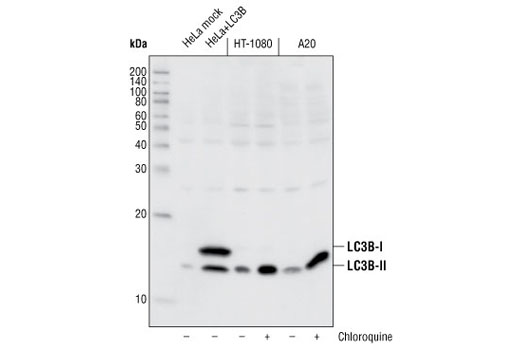 Western Blotting Image 1: LC3B Antibody