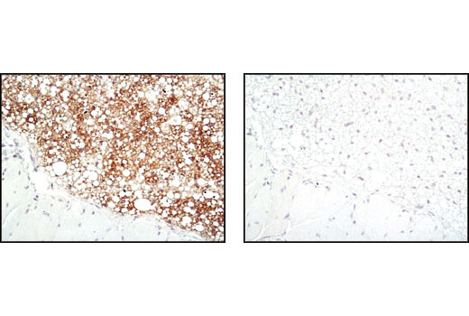 Immunohistochemistry Image 3: SCD1 (C12H5) Rabbit mAb