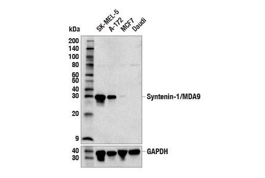 Western Blotting Image 1: Syntenin-1/MDA9 (E2I9L) Rabbit mAb