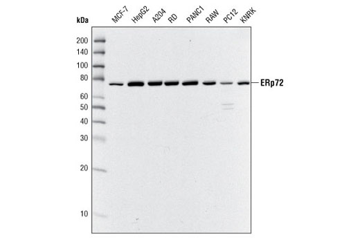 Western Blotting Image 1: ERp72 Antibody