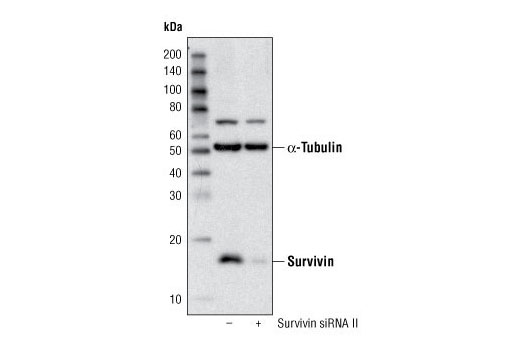  Image 15: Astrocyte Markers Antibody Sampler Kit