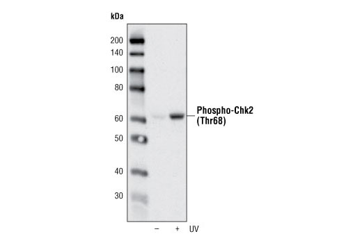 Western Blotting Image 1: Phospho-Chk2 (Thr68) (C13C1) Rabbit mAb (BSA and Azide Free)