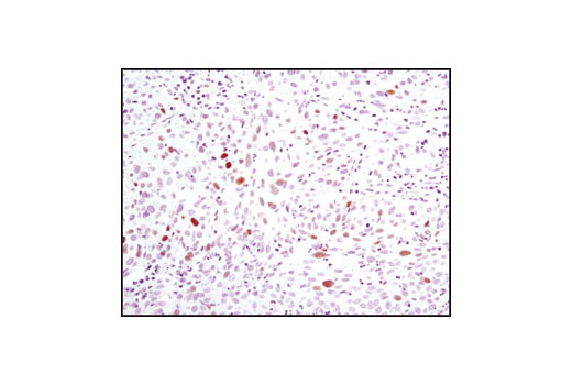 Immunohistochemistry Image 3: Phospho-Chk2 (Thr68) (C13C1) Rabbit mAb (BSA and Azide Free)