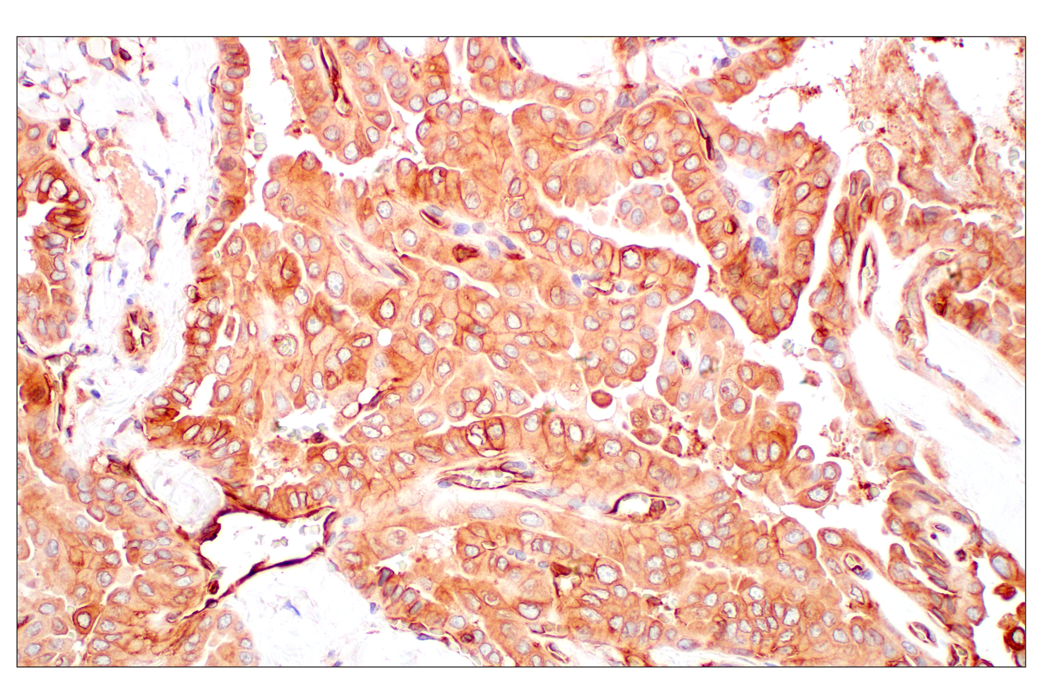 Immunohistochemistry Image 2: MHC Class I (EMR8-5) Mouse mAb (BSA and Azide Free)