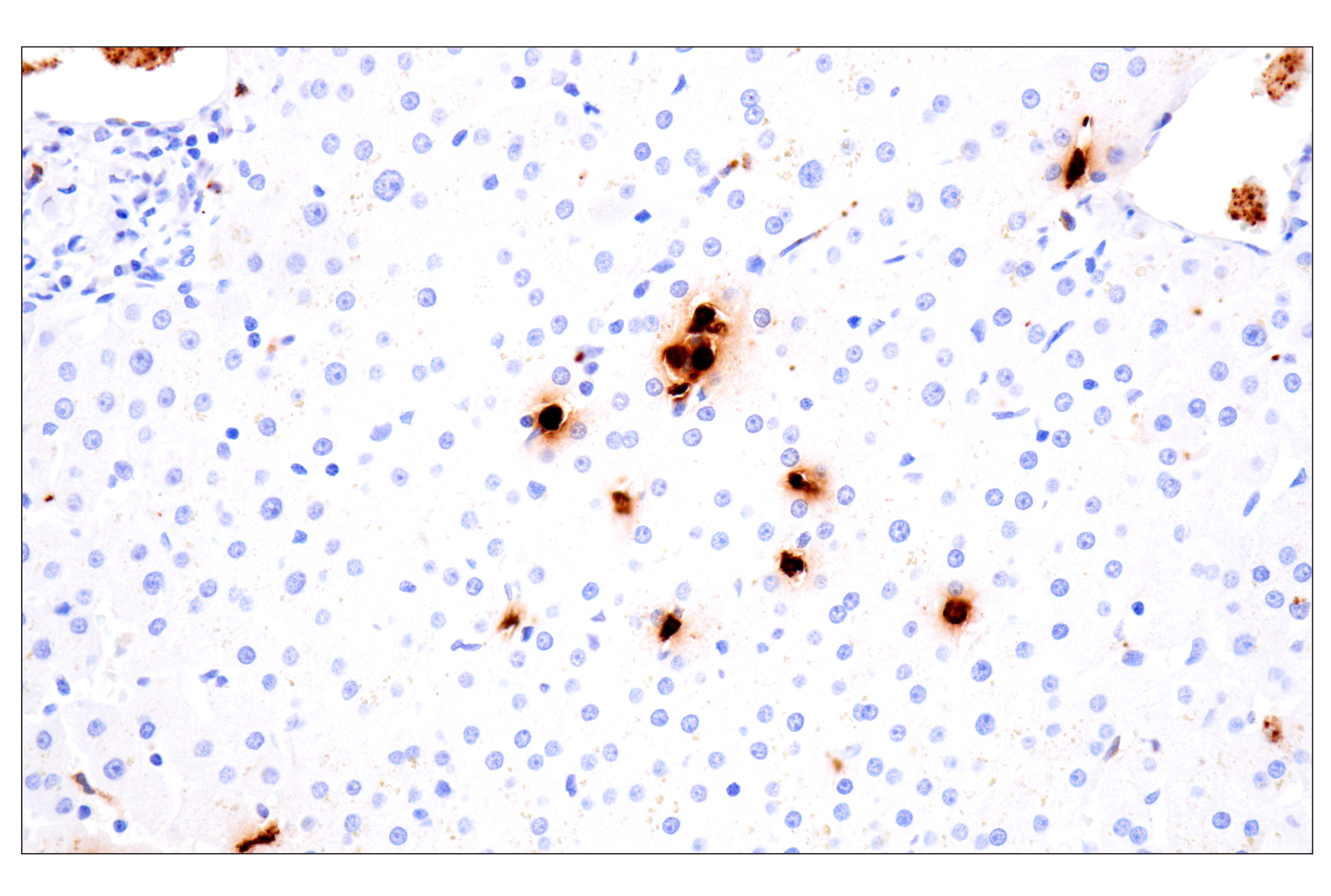 Immunohistochemistry Image 9: Neutrophil Elastase (F4H3X) Rabbit mAb