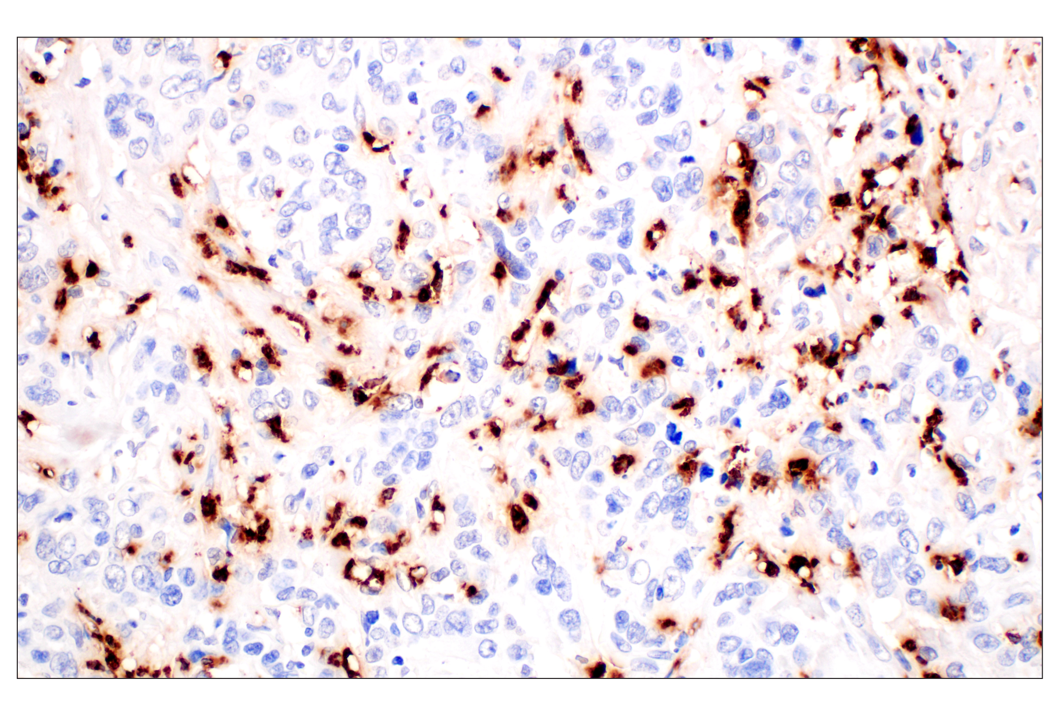 Immunohistochemistry Image 4: Neutrophil Elastase (F4H3X) Rabbit mAb