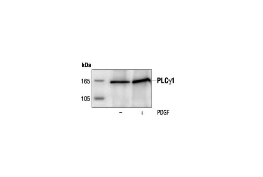 Immunoprecipitation Image 1: PLCγ1 Antibody
