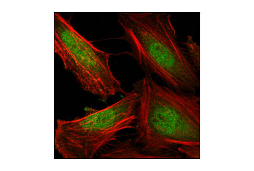 Immunofluorescence Image 1: MEP50 Antibody