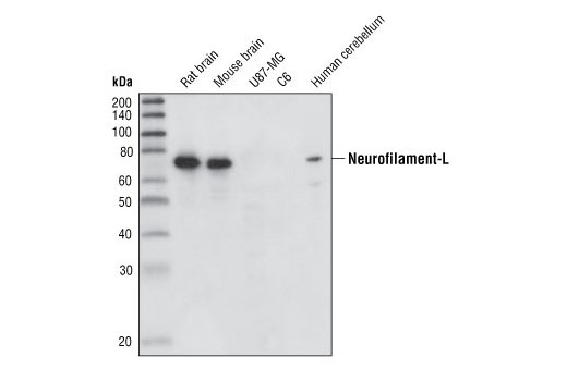 Western Blotting Image 1: Neurofilament-L (DA2) Mouse mAb