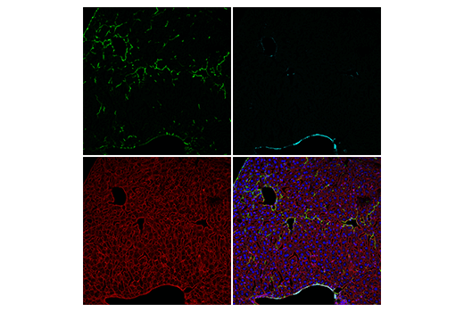 Immunofluorescence Image 2: COL1A1 (E8F4L) XP® Rabbit mAb (Alexa Fluor® 488 Conjugate)