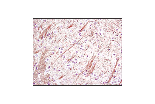Immunohistochemistry Image 1: Neurofilament-L (C28E10) Rabbit mAb