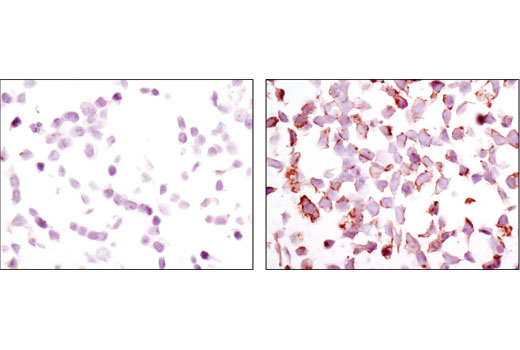 Immunohistochemistry Image 4: Phospho-HER3/ErbB3 (Tyr1289) (D1B5) Rabbit mAb