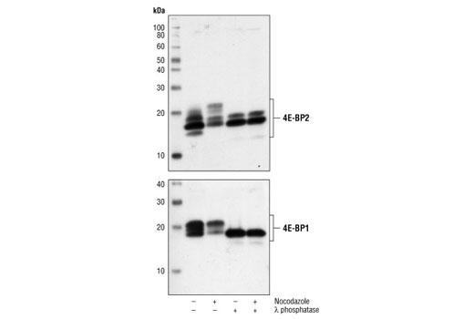  Image 3: 4E-BP Antibody Sampler Kit