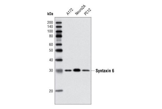 Western Blotting Image 1: Syntaxin 6 (C34B2) Rabbit mAb