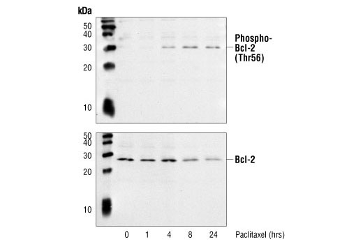  Image 7: Pro-Survival Bcl-2 Family Antibody Sampler Kit