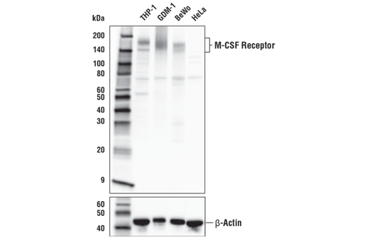 Image 5: Suppressive Myeloid Cell Phenotyping IHC Antibody Sampler Kit
