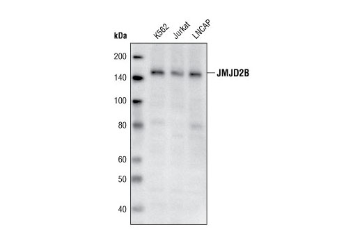 Western Blotting Image 1: JMJD2B Antibody