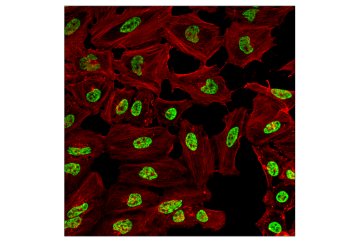  Image 1: Methyl-Histone H3 (Lys36) Antibody Sampler Kit