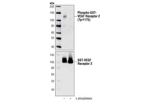 Western Blotting Image 1: VEGF Receptor 2 Control Proteins