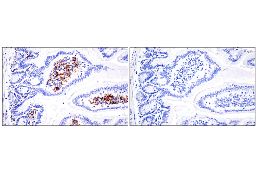 Immunohistochemistry Image 11: CD68 (E3O7V) Rabbit mAb (BSA and Azide Free)