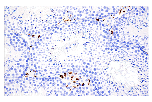 Immunohistochemistry Image 4: CD68 (E3O7V) Rabbit mAb (BSA and Azide Free)