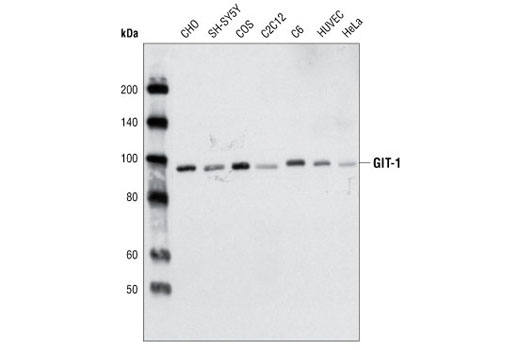 Western Blotting Image 1: GIT-1 Antibody