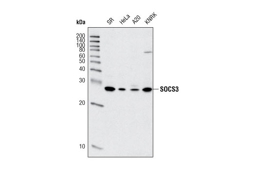 Western Blotting Image 1: SOCS3 Antibody