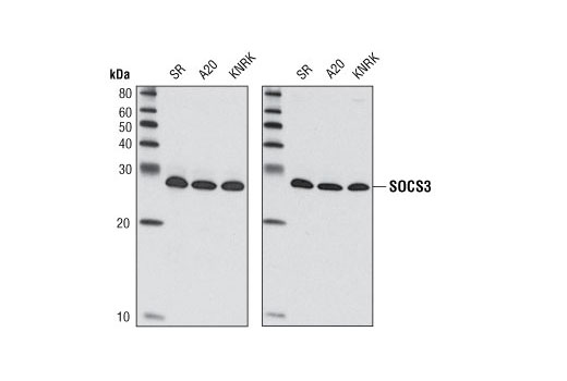 Western Blotting Image 1: SOCS3 (L210) Antibody