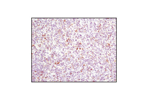  Image 35: Pro-Apoptosis Bcl-2 Family Antibody Sampler Kit II