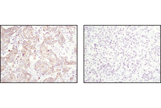  Image 36: Pro-Apoptosis Bcl-2 Family Antibody Sampler Kit II