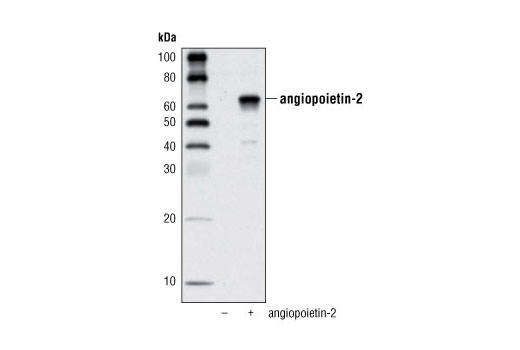 Western Blotting Image 1: Angiopoietin-2 Antibody