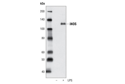 Western Blotting Image 1: iNOS Antibody