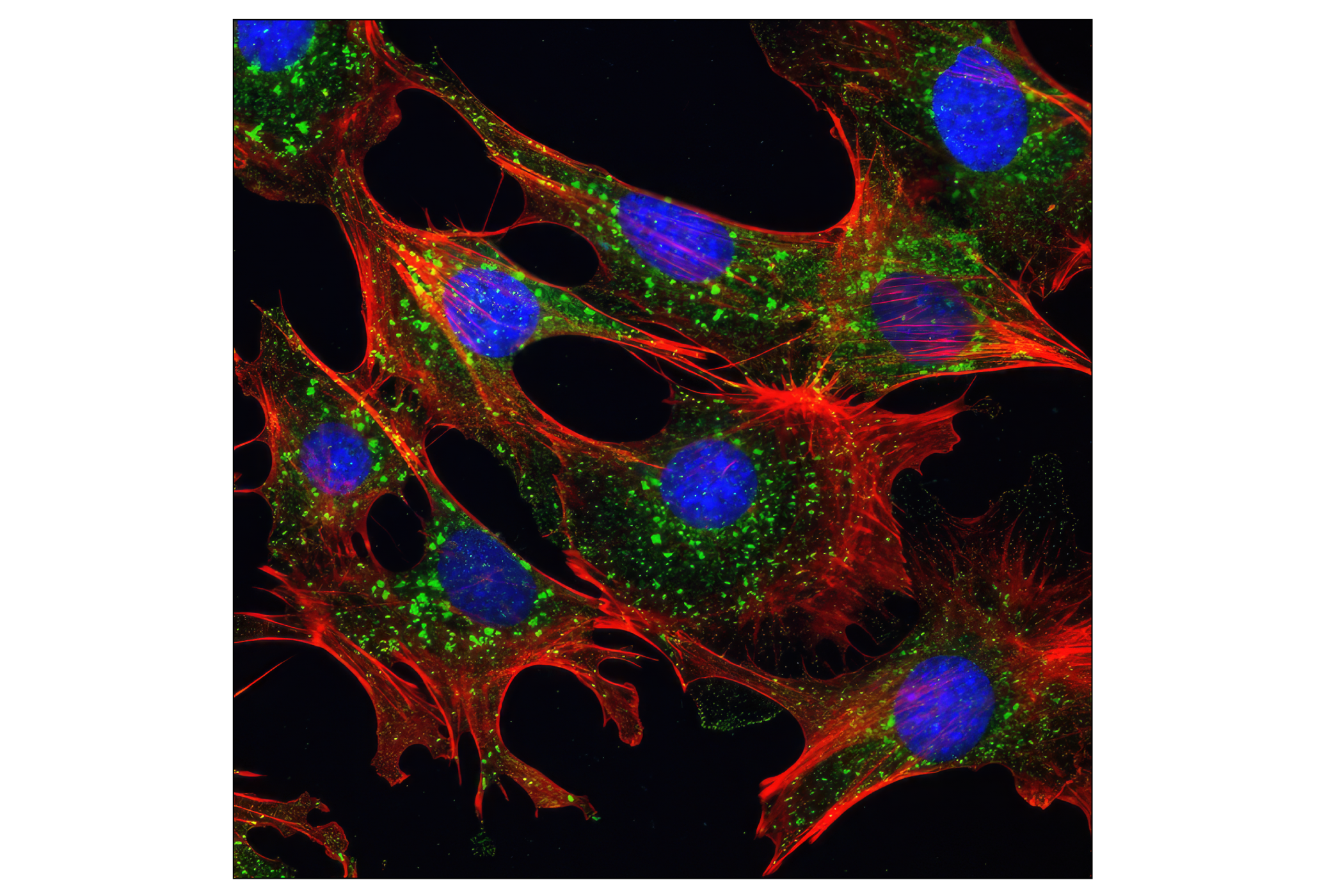 Immunofluorescence Image 1: mTOR (7C10) Rabbit mAb
