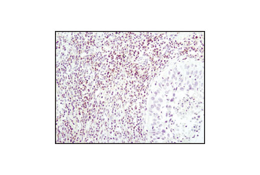 Immunohistochemistry Image 1: Lck (D88) XP® Rabbit mAb