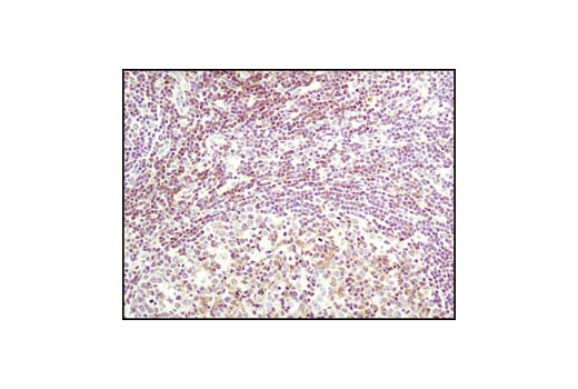 Immunohistochemistry Image 4: Lck (D88) XP® Rabbit mAb