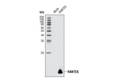  Image 14: Senescence Associated Secretory Phenotype (SASP) Antibody Sampler Kit
