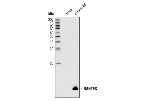 Western Blotting Image 1: CCL5/RANTES Antibody