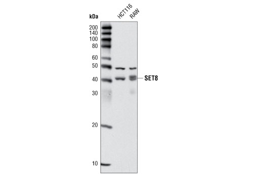  Image 5: Lysine Methyltransferase Antibody Sampler Kit
