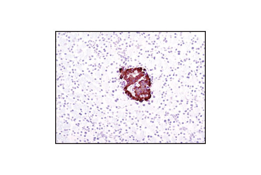  Image 18: Pancreatic Marker IHC Antibody Sampler Kit