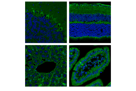 Immunofluorescence Image 1: Nicastrin (D4F6N) Rabbit mAb