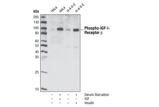 Western Blotting Image 1: Phospho-IGF-I Receptor β (Tyr1135/1136)/Insulin Receptor β (Tyr1150/1151) (19H7) Rabbit mAb