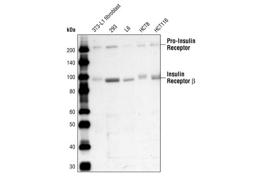 Western Blotting Image 1: Insulin Receptor β (4B8) Rabbit mAb
