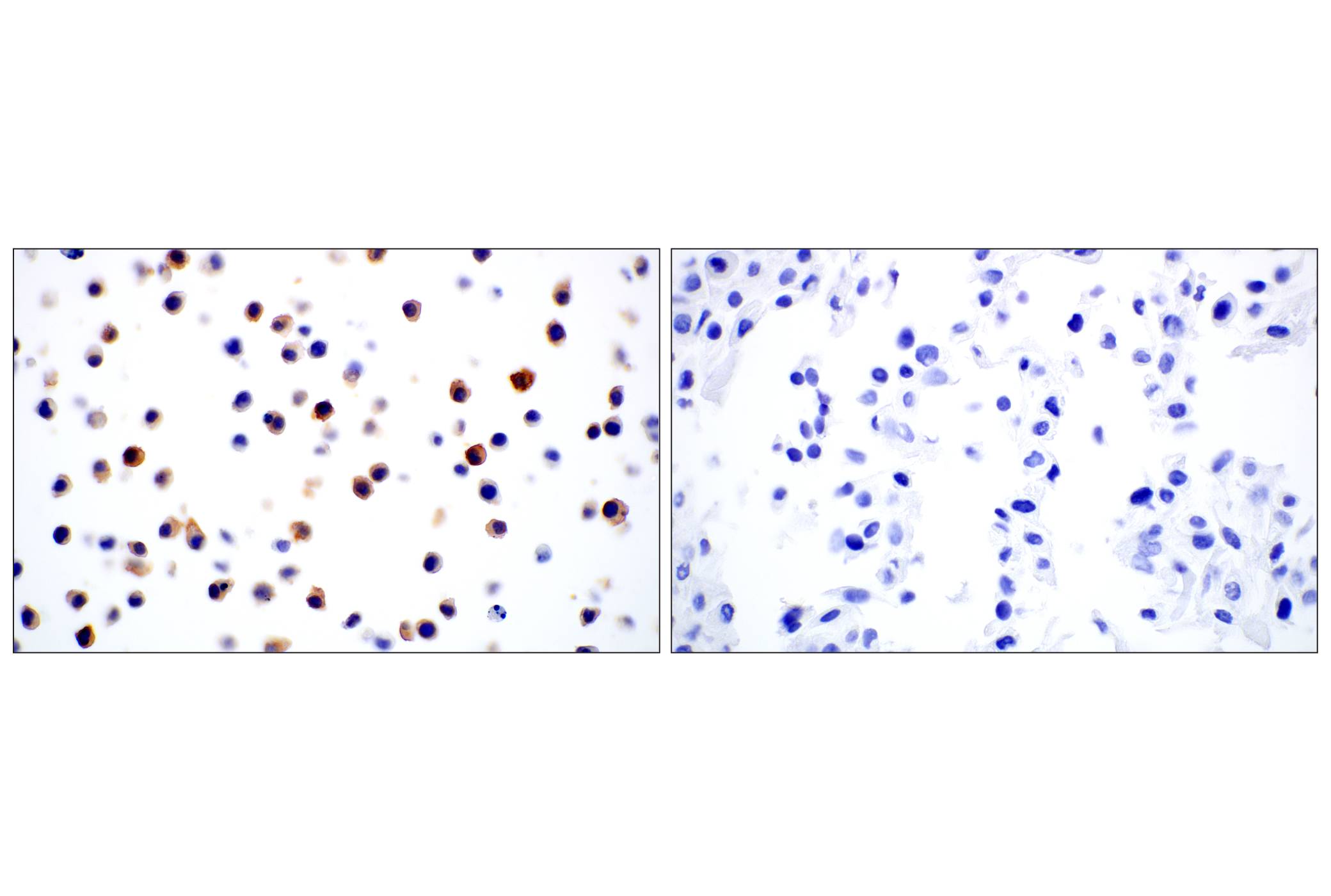 Immunohistochemistry Image 7: Dectin-1/ Clec7a (E3P5W) Rabbit mAb