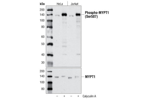  Image 1: MYPT1 Antibody Sampler Kit