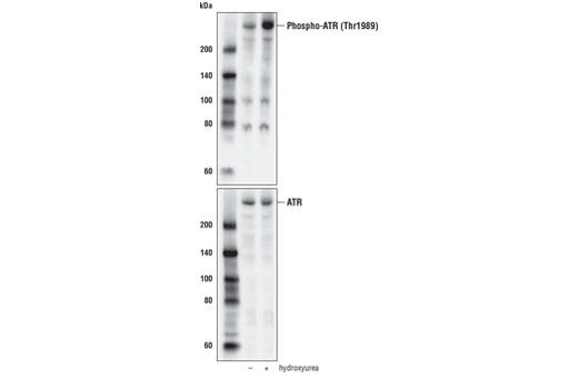  Image 3: PhosphoPlus® ATR (Thr1989) Antibody Duet