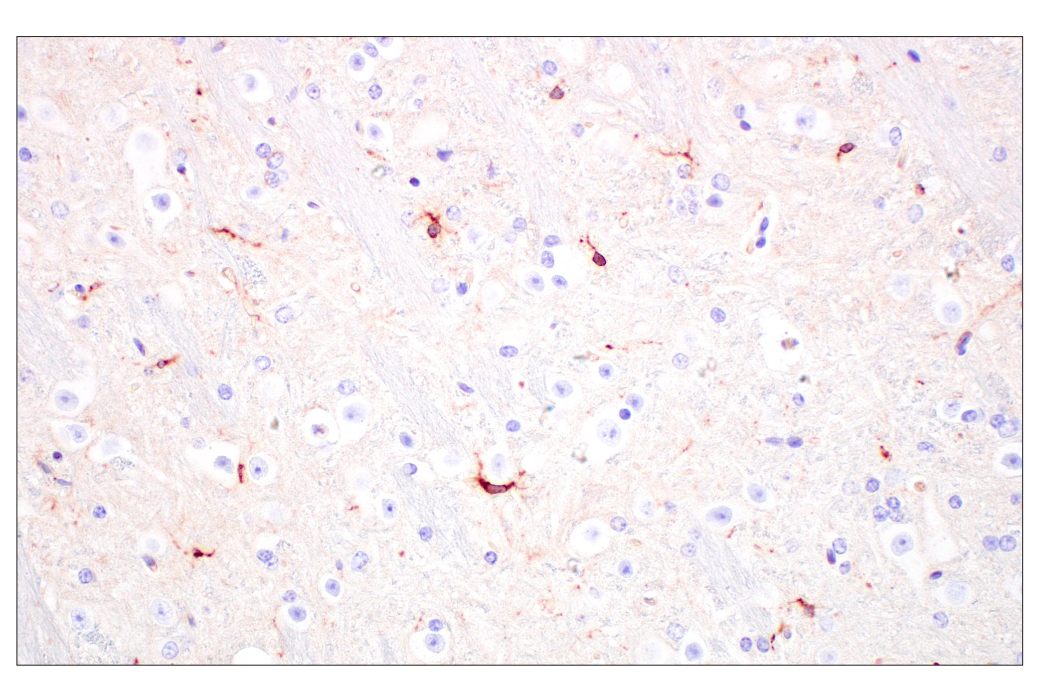 Immunohistochemistry Image 7: C1QB (E3U6X) Rabbit mAb