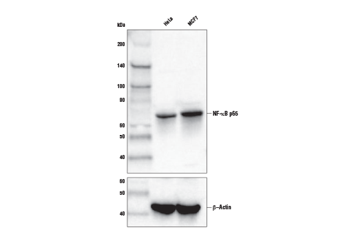 Western Blotting Image 1: NF-κB p65 (D14E12) XP® Rabbit mAb (Biotinylated)