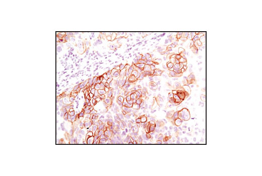 Immunohistochemistry Image 4: Phospho-Met (Tyr1234/1235) (D26) XP® Rabbit mAb (BSA and Azide Free)